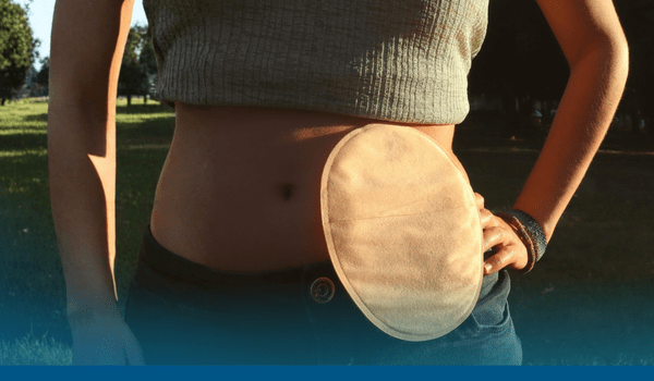 Novo no app: solicite Implanon, anticoagulantes para gestantes e acessórios para implante coclear e ostomias