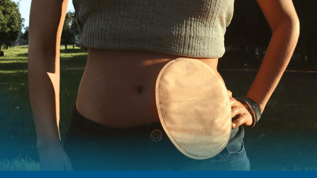 Novo no app: solicite Implanon, anticoagulantes para gestantes e acessórios para implante coclear e ostomias