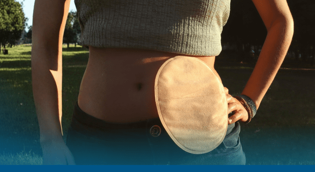 Novo no app: solicite Implanon, anticoagulantes para gestantes e acessórios para implante coclear e ostomias